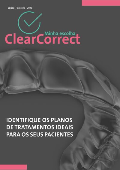 ClearCorrect: Caso Clínico de Tratamento Ortodôntico em Dentadura Mista